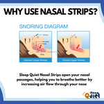 Load image into Gallery viewer, &quot;Buy 1 Get 3&quot; Sleep Quiet Strong Large Tan Nasal Strips
