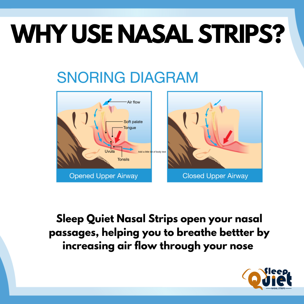 "Buy 1 Get 3 " Sleep Quiet Clear Original (1 Size Large / Medium) Nasal Strips