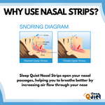 Load image into Gallery viewer, &quot;Buy 1 Get 3 &quot; Sleep Quiet Clear Original (1 Size Large / Medium) Nasal Strips
